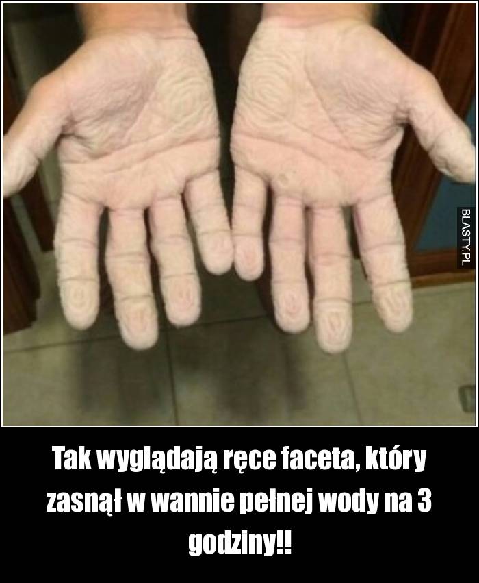 Tak wyglądają ręce faceta, który zasnął w wannie pełnej wody na 3 godziny!!