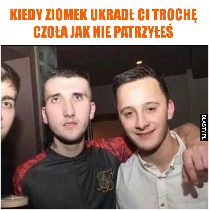 Kiedy ziomek ukradł Ci trochę czoła jak nie patrzyłeś