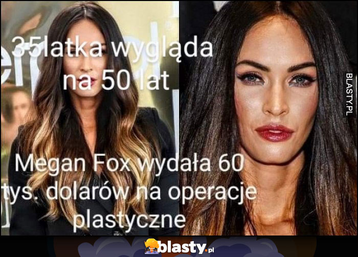 Megan Fox - operacje plastyczne