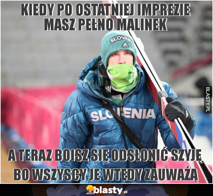 Kiedy po ostatniej imprezie masz pełno malinek