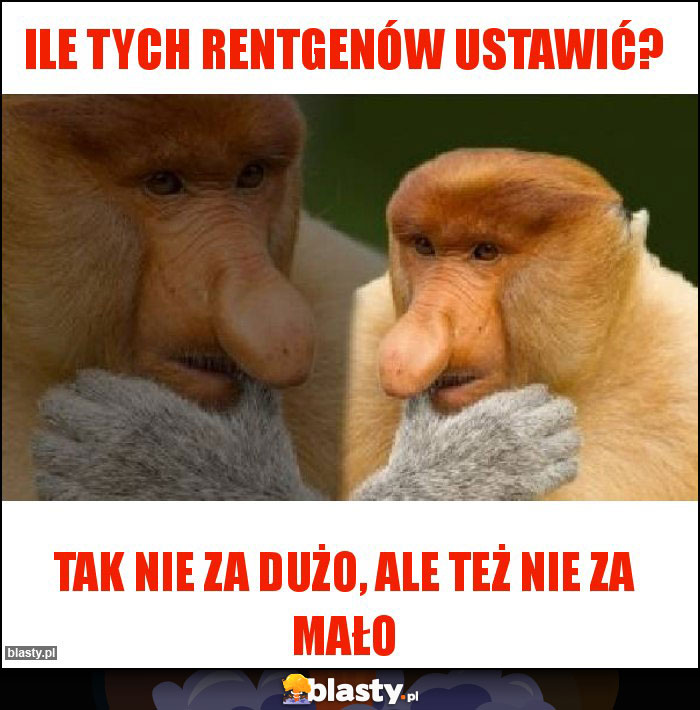 Ile tych rentgenów ustawić?