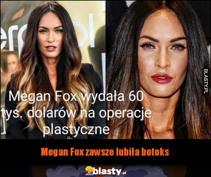 Megan Fox po operacjach